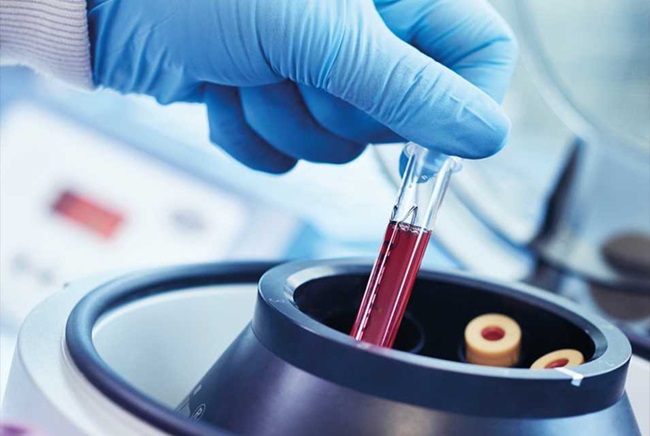 laboratory tests for cardiac genetics